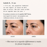 NORYA InstaLift PDRN 360° - image 7