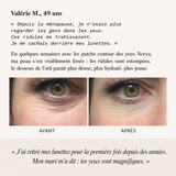 NORYA InstaLift PDRN 360° - image 8